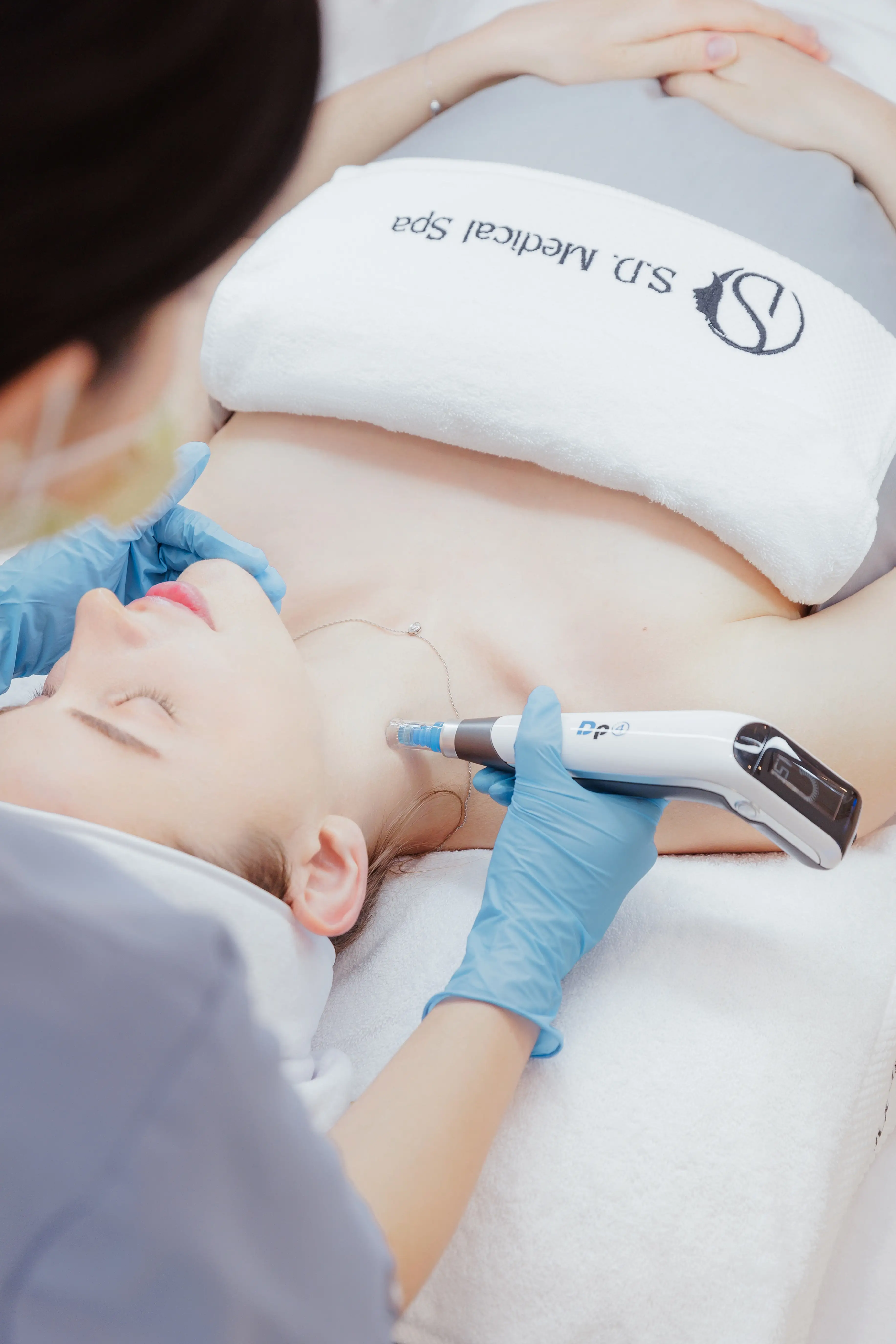A gloved hand guiding a handheld treatment device across the skin at S.D. Medical Spa in Oakville.